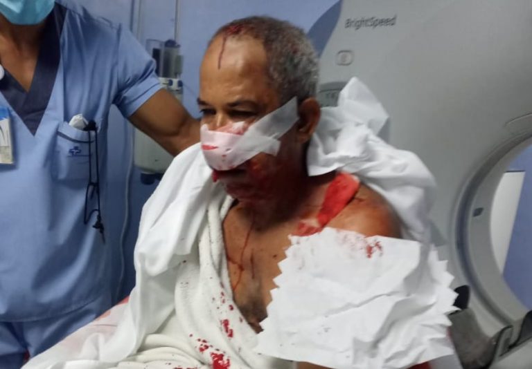Entrenador de beisbol es atracado y golpeado a palos por dos alegados haitianos.