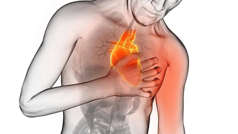 Siguen las muertes por infartos en el pais