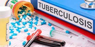 Un nuevo tratamiento revoluciona la lucha contra la tuberculosis “resistente”