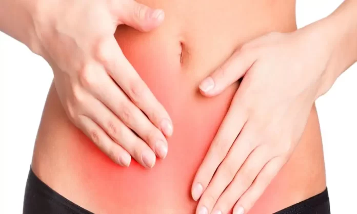 endometriosis