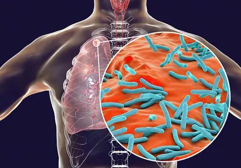 pulmones