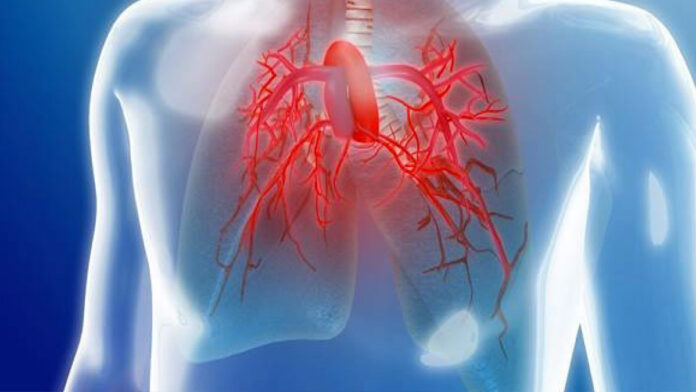 pulmonar